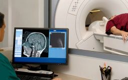 MRI thoát vị đĩa đệm - Phương pháp chẩn đoán bệnh chính xác nhất hiện nay