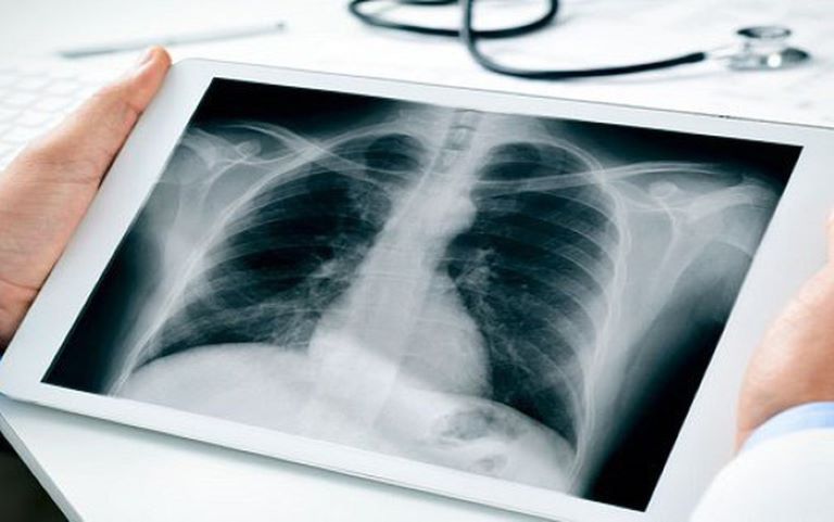 Các biện pháp chụp X- quang sẽ giúp chẩn đoán chính xác tình trạng bệnh