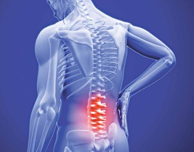 Chứng đau lưng nhức mỏi vai gáy có thể sử dụng thuốc đông y để điều trị