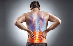 Các bệnh lý cột sống - thắt lưng là nguyên nhân chính dẫn tới các cơn đau kéo dài