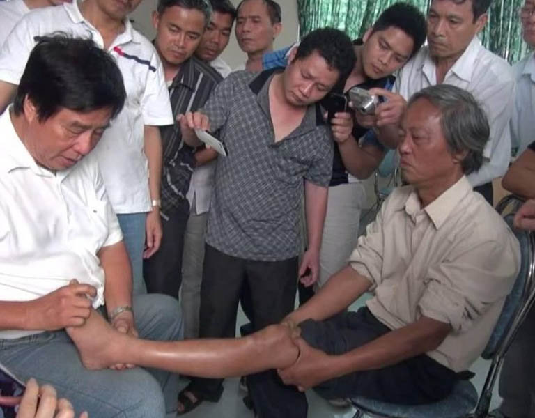 Bác sĩ Dư Quang Châu chữa thoát vị đĩa đệm bằng phương pháp bấm huyệt