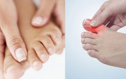 Thường xuyên đau ngón tay, ngón chân do bệnh thoái hóa khớp