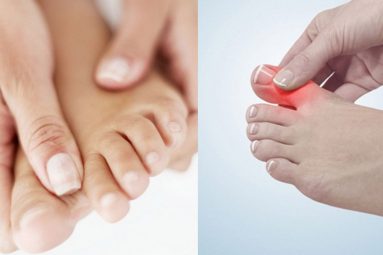 Thường xuyên đau ngón tay, ngón chân do bệnh thoái hóa khớp