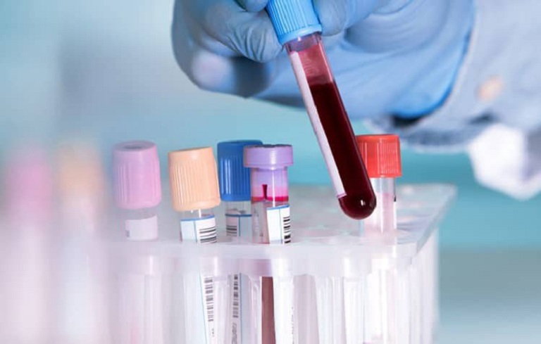 Người bệnh bắt buộc phải thực hiện xét nghiệm máu khi thăm khám