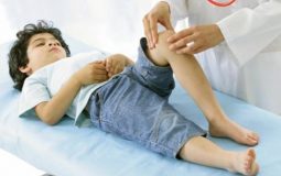 Viêm khớp gối ở trẻ em: Tổng hợp thông tin chi tiết nhất