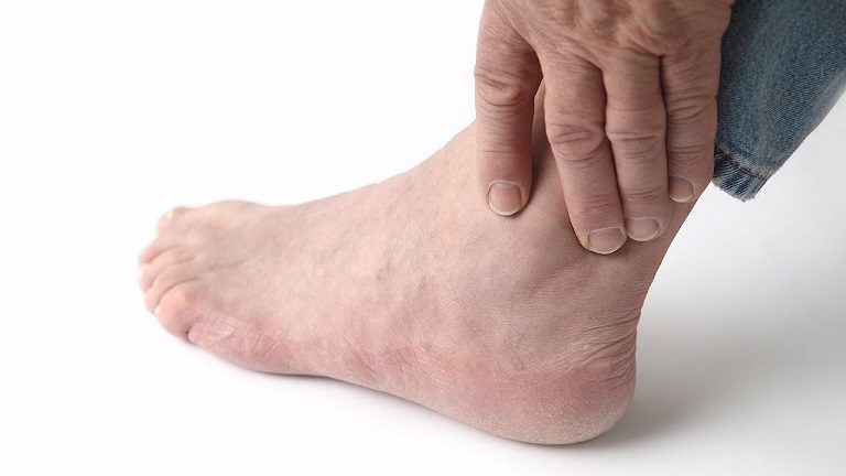 Một số bệnh lý là nguyên nhân gây phản ứng viêm ở các mô mềm xung quanh khớp cổ chân. 