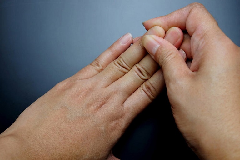 Sưng khớp ngón tay khiến khả năng vận động người bệnh bị hạn chế