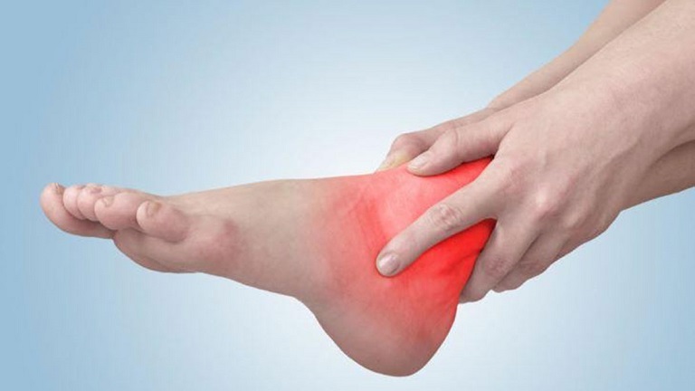 Đau nhức khớp cổ chân là biểu hiện cấp tính ban đầu của bệnh. 
