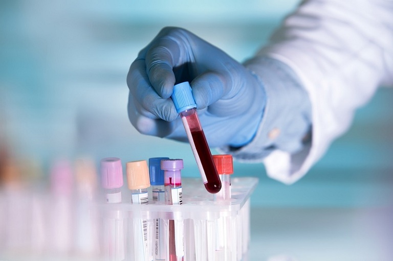 Xét nghiệm máu giúp bác sĩ xác định người bệnh có bị viêm khớp nhiễm khuẩn hay không