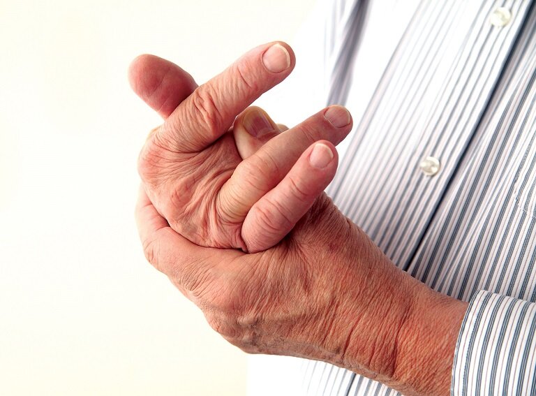 Viêm khớp tay là tình trạng tổn thương mề mặt sụn do nhiều nguyên nhân khác nhau. 