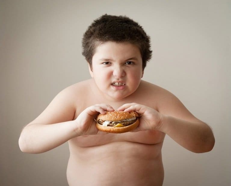 Trẻ em bị béo phì có nguy cơ mắc bệnh cao hơn so với trẻ bình thường