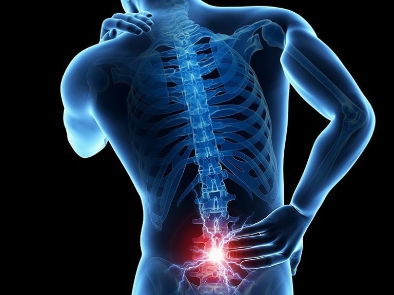 Các cơn đau nhức liên tục ở cột sống chính là triệu chứng điển hình của bệnh loãng xương